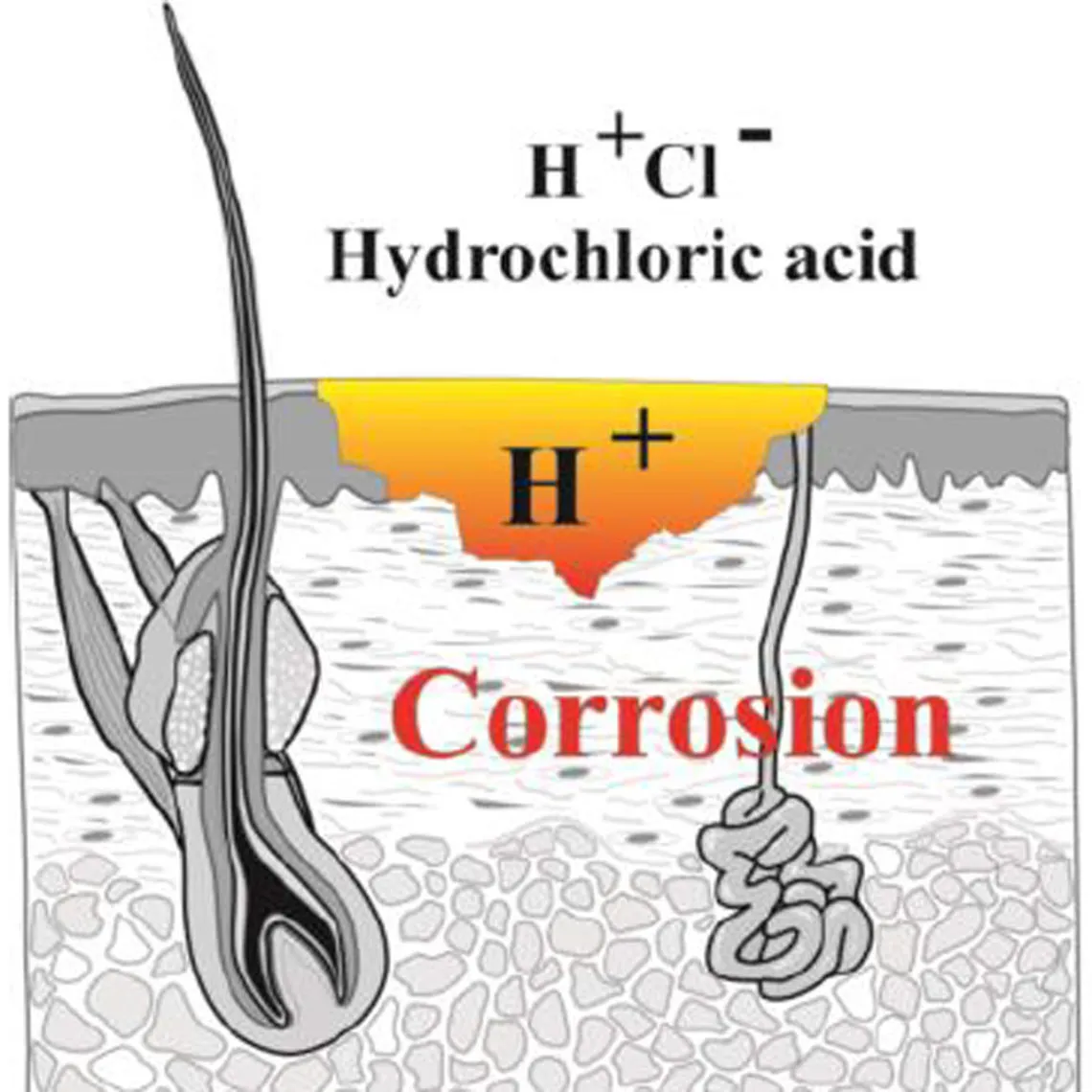 Diagramm der Auswirkungen von Salzsäure auf den Organismus, der mit ihr in Berührung kommt: Korrosion