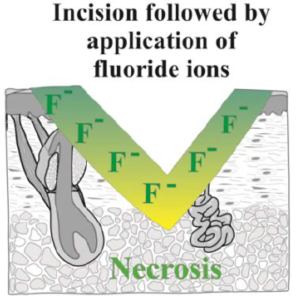 diagrama que muestra los efectos de una incisión seguida de la aplicación de iones de flúor: necrosis